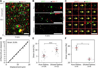 ECM-transmitted shear stress induces apoptotic cell extrusion in early breast gland development